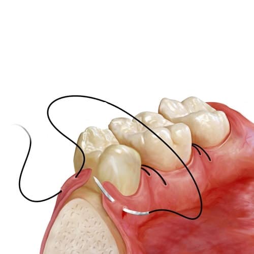 Χειρουργική του Στόματος